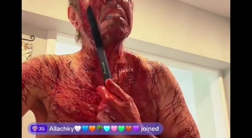 Perez Hilton losing his mind