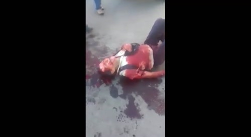 Old Man Dies After Dog Attack