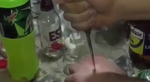 Russian guy gets a knife straight through his hand