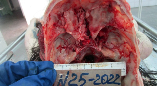 The Beautiful Autopsy