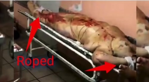 Organ harvesting
