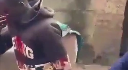 Protester Gets Shot In The Face
