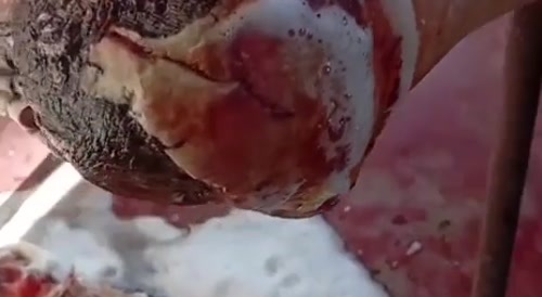 As a result of stepping on a mine, the russian soldier&rsquo;s foot was mangled into a hoof-like stump.