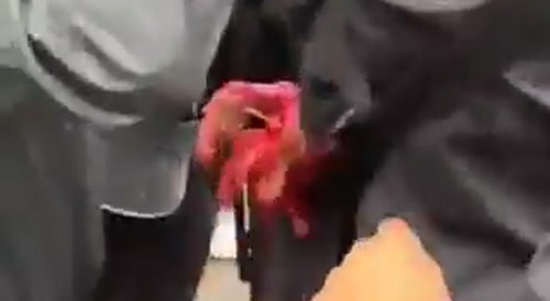 Paris Protestor gets Hand Blown Off