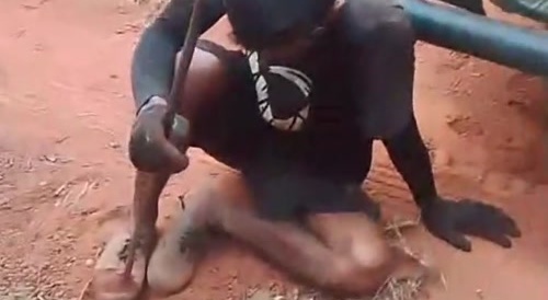 Ended Up Impaling His Foot