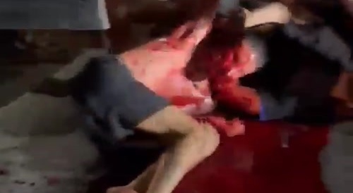 No face after failed robbery
