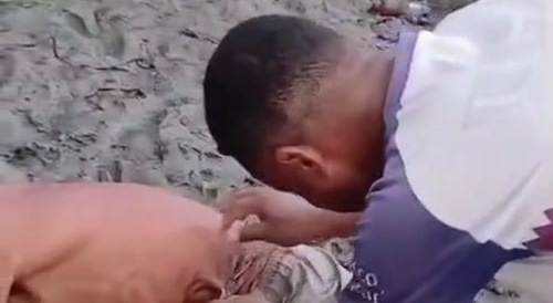 Excruciating Pain After Stingray Stabbing